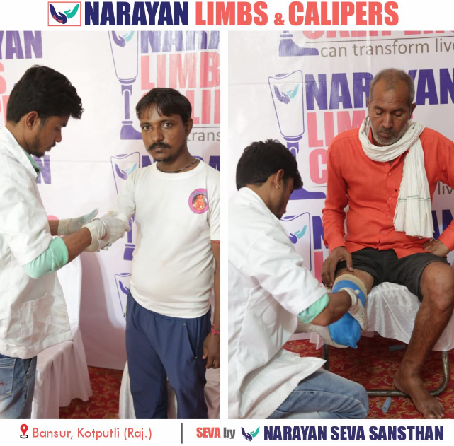 narayan-limb-and-caliper-measurement-camp-organized-in-bansur
