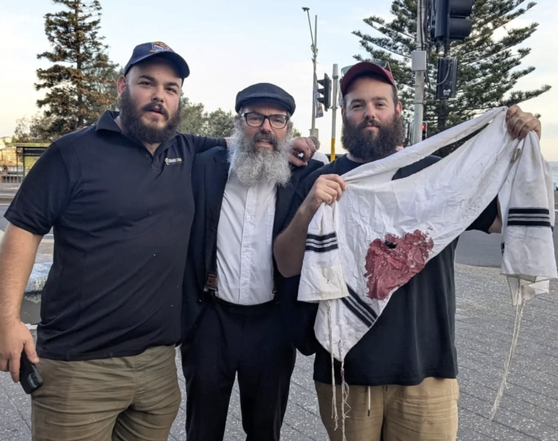 bondi-beach-shooting-what-is-known-so-far2-people-dead-including-one-of-the-two-gunmen-and-29-others-injured