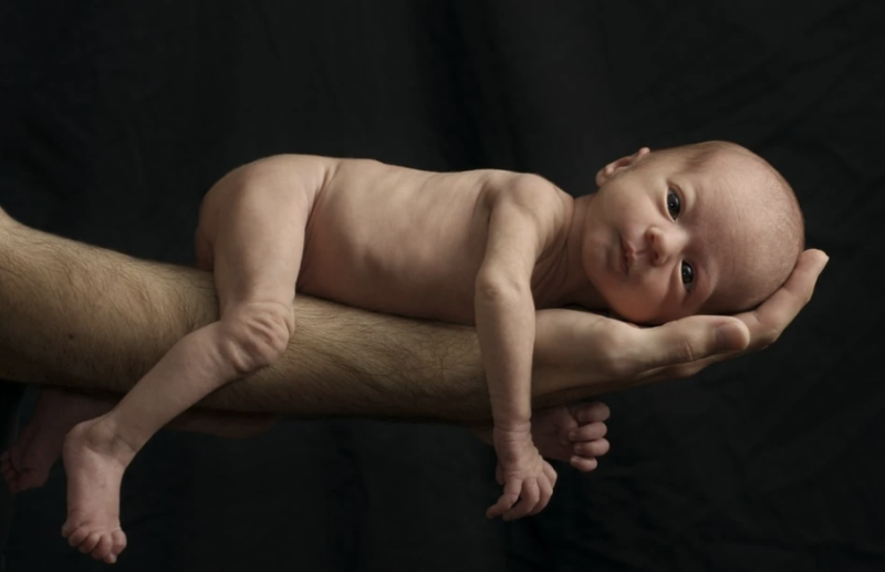 1-in-10-babies-is-born-premature-doctors-advocate-increased-care