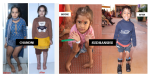 over-45-lakh-free-surgeries-for-the-differently-abled-nss-transforms-lives-through-healthcare-rehabilitation-skill-development