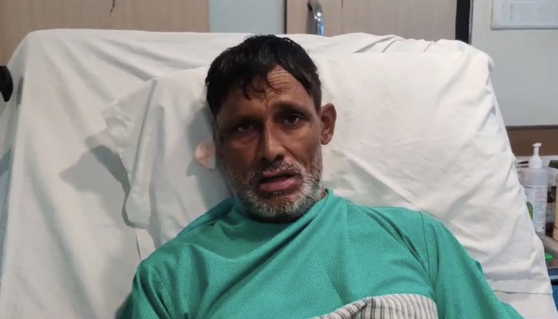 against-all-odds-the-remarkable-recovery-of-a-sundarbans-resident-from-a-devastating-tiger-attack