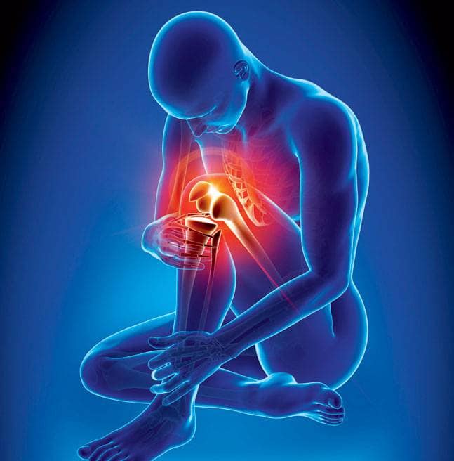 rise-in-arthritis-problems-among-young-generation