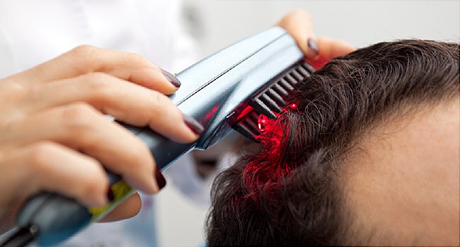 qr-678-neo-hair-fall-and-hair-regrowth-therapy-has-received-the-us-and-indian-patent-and-is-indian-fda-approved