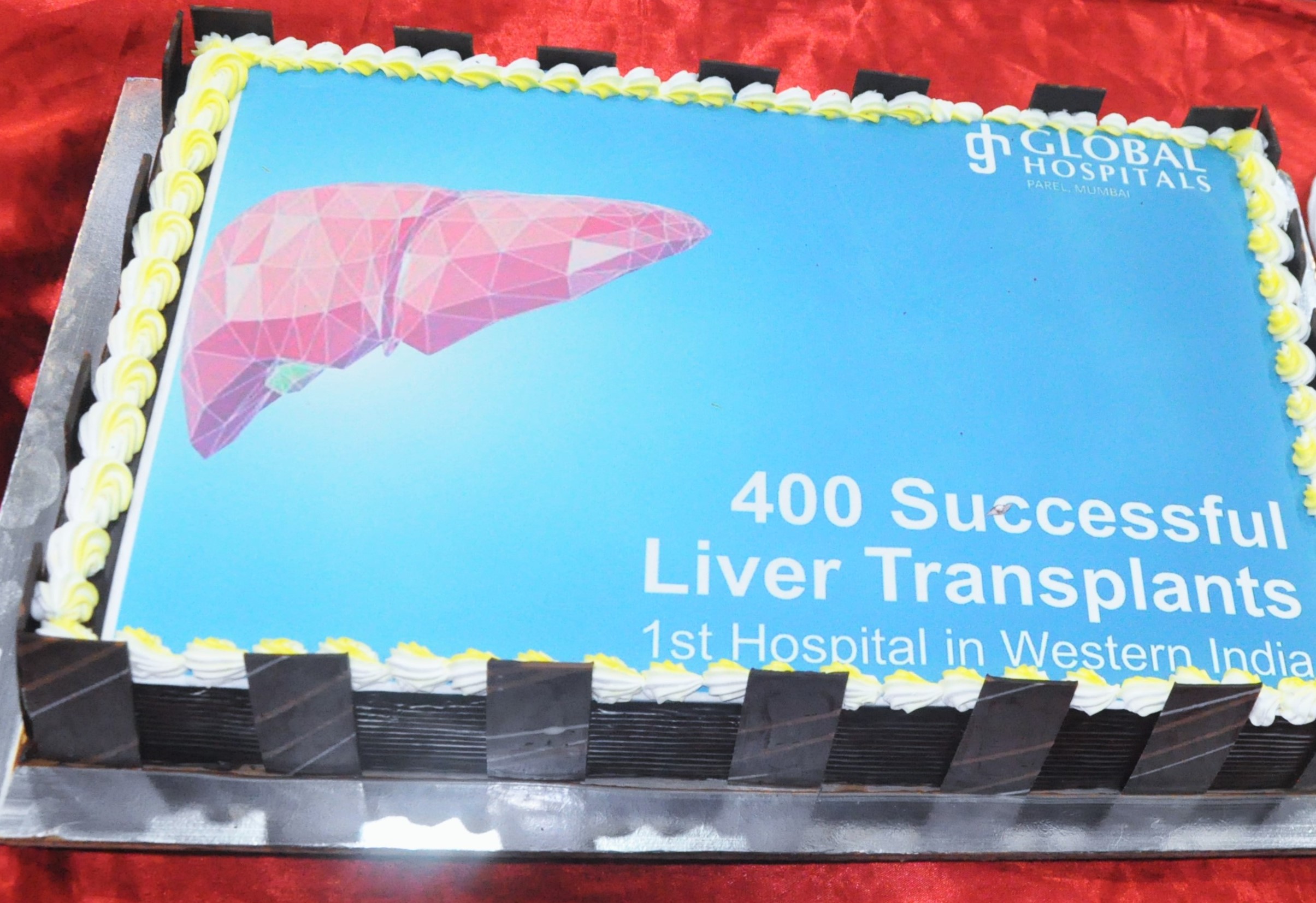 global-hospital-team-first-to-perform-more-than-400-liver-transplants-in-western-india-celebrates-6-years-anniversary