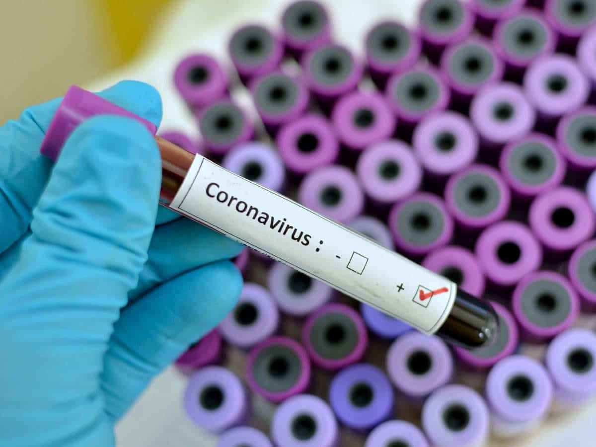 special-precautions-before-covid-19-vaccination