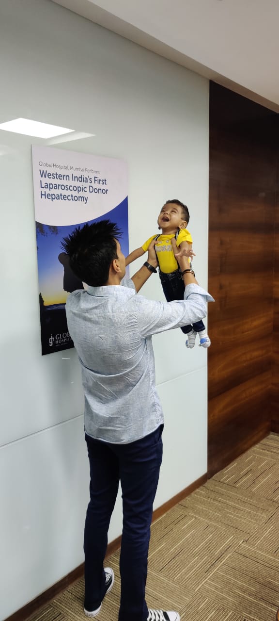 western-indias-first-total-laparoscopic-donor-hepatectomy-for-transplant-of-a-1-year-old-child