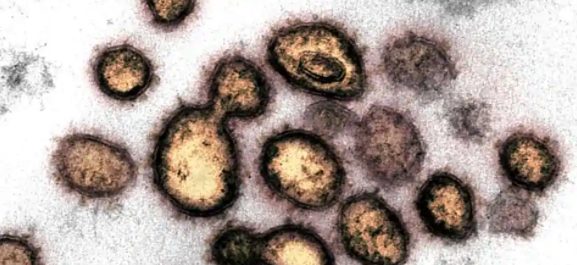 bad-cholesterol-rise-in-youngsters-during-covid-times-revealed-study