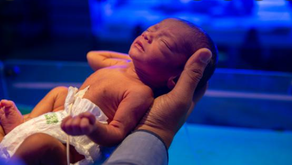 it-is-essential-to-breastfeed-premature-babies-in-the-nicu-doctor