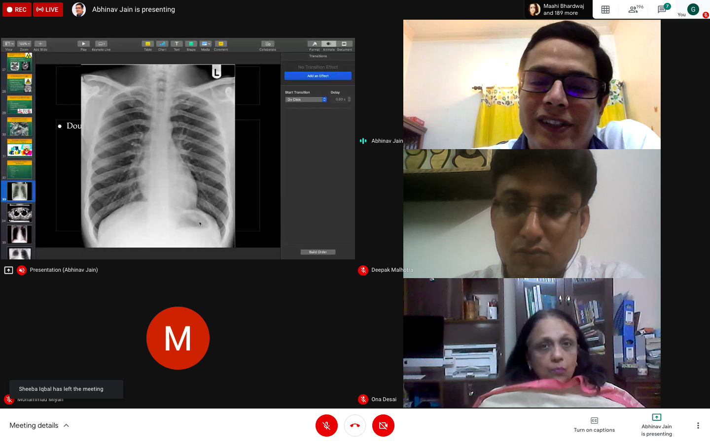 jamia-hamdard-organizes-webinar-on-the-basic-concepts-of-x-ray-and-mri-for-physiotherapy-and-occupational-therapy-professionals