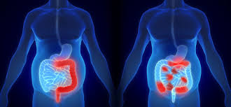 48-year-old-woman-with-rectal-cancer-successfully-treated-at-wockhardt-hospital