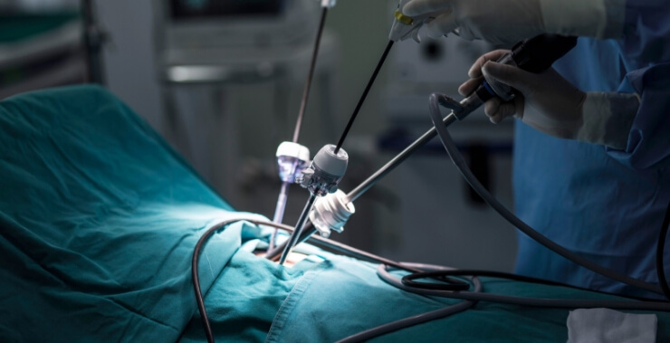 minimal-invasive-robotic-surgeries-in-renal-transplantation-has-better-outcomes
