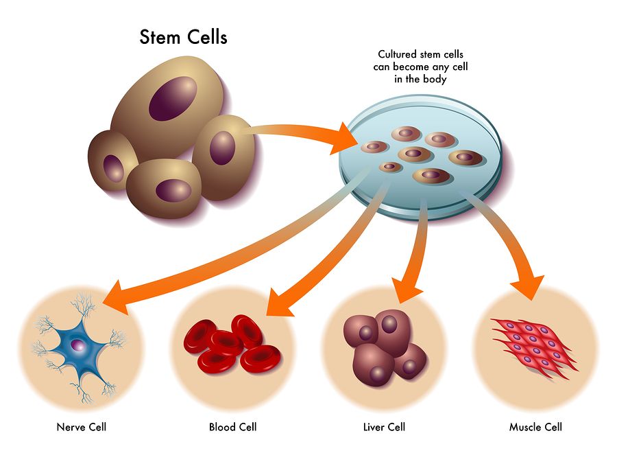 22-year-old-bangladeshi-boy-suffering-from-avascular-necrosis-treated-with-advanced-stem-cell-regenerative-technique